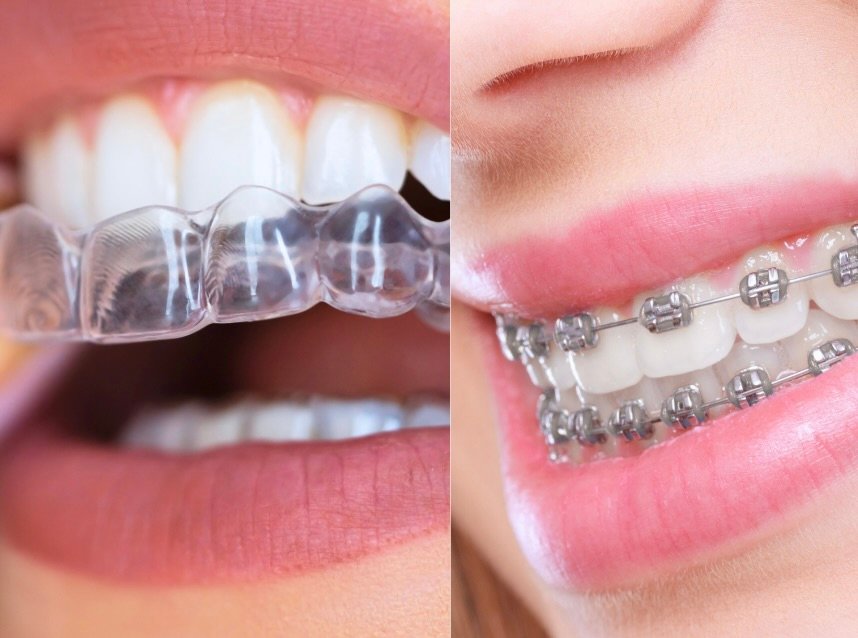 Unveiling Orang Indo: Everything You Need to Know About the People of Indonesia